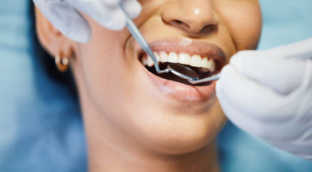 Best Emergency Root Canal Treatment in Concord, AL